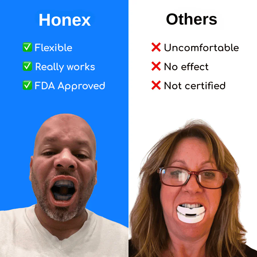 HoneX The Quiet Anti-Snoring Mouthpiece Universal Size