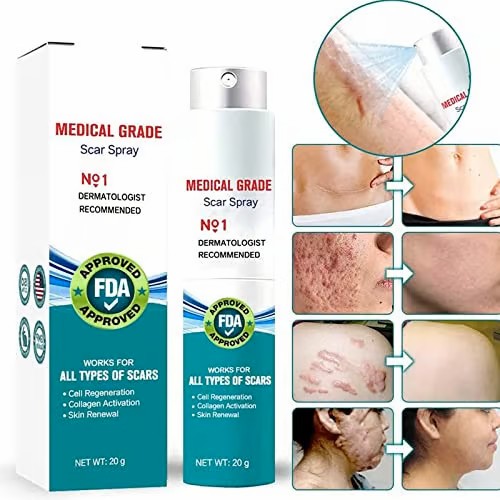 Say Goodbye to Scars  Reveal Clearer, Smoother Skin With our powerful Scar Remover Cream