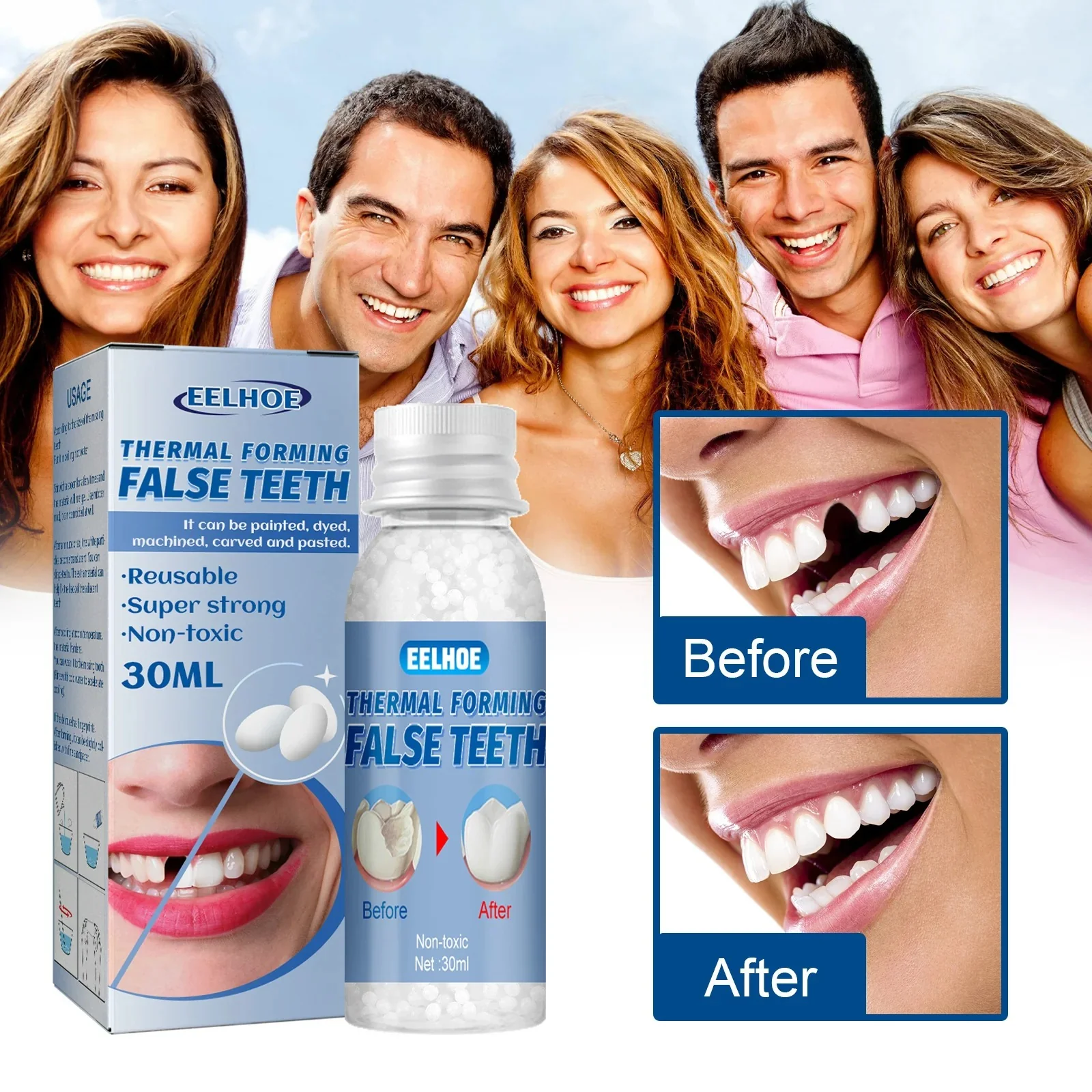 Eelhoe Temporary Dental Restorations: The perfect solution for gaps and missing teeth!